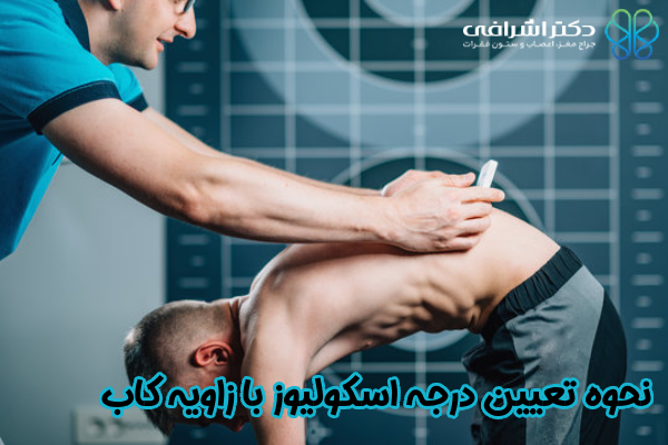 نحوه تعیین درجه اسکولیوز با زاویه کاب