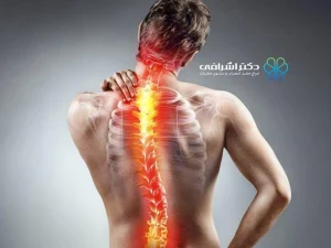 چگونه درجه انحراف ستون فقرات تعیین می شود؟