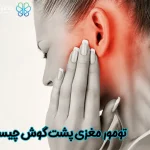 تومور مغزی پشت گوش چیست