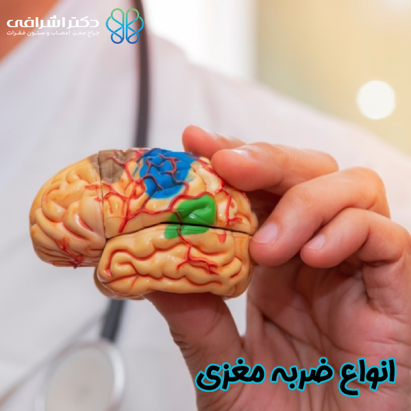 انواع ضربه مغزی