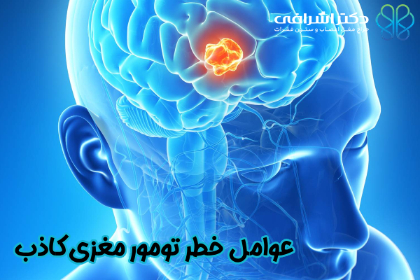 عوامل خطر تومور مغزی کاذب