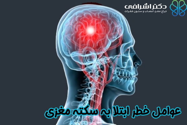 عوامل خطر ابتلا به سکته مغزی