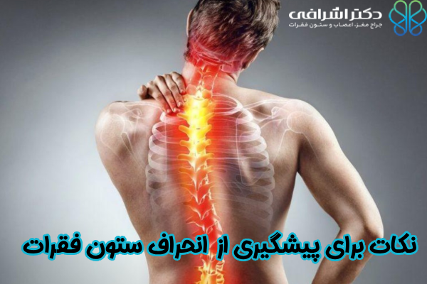 نکات برای پیشگیری از انحراف ستون فقرات