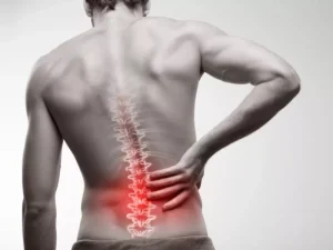 علائم دیسک کمر